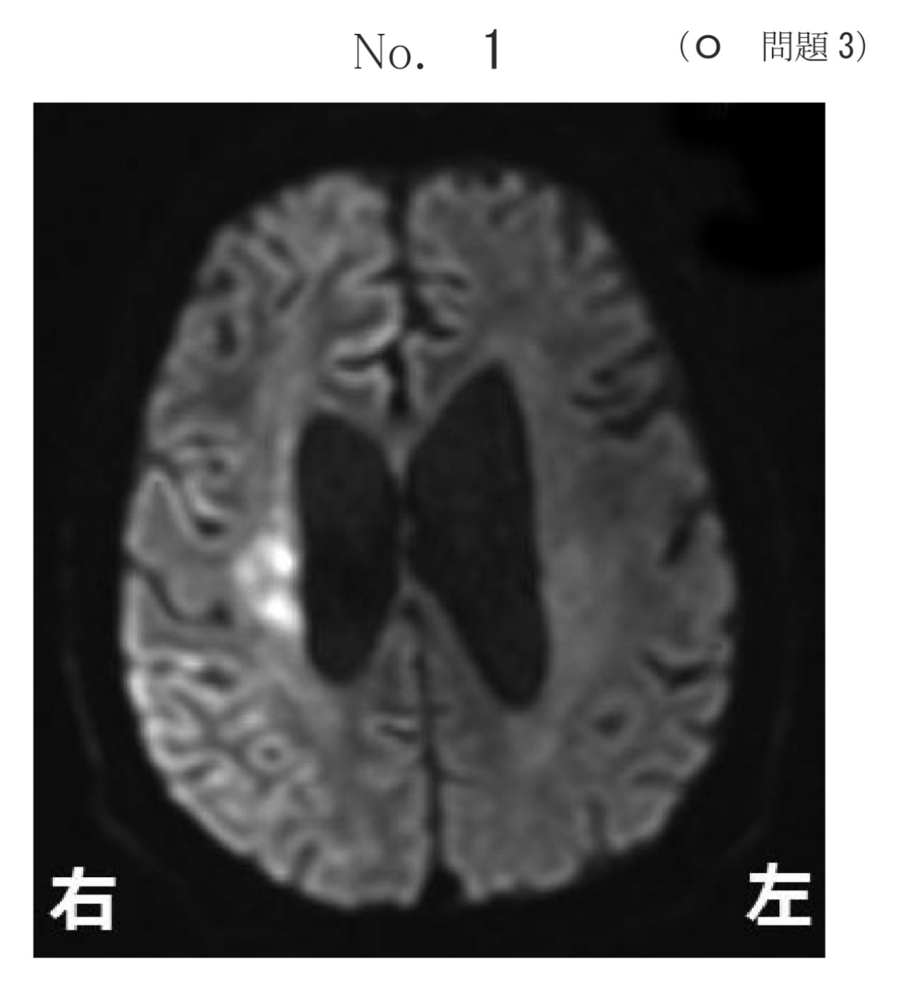 問題3の図