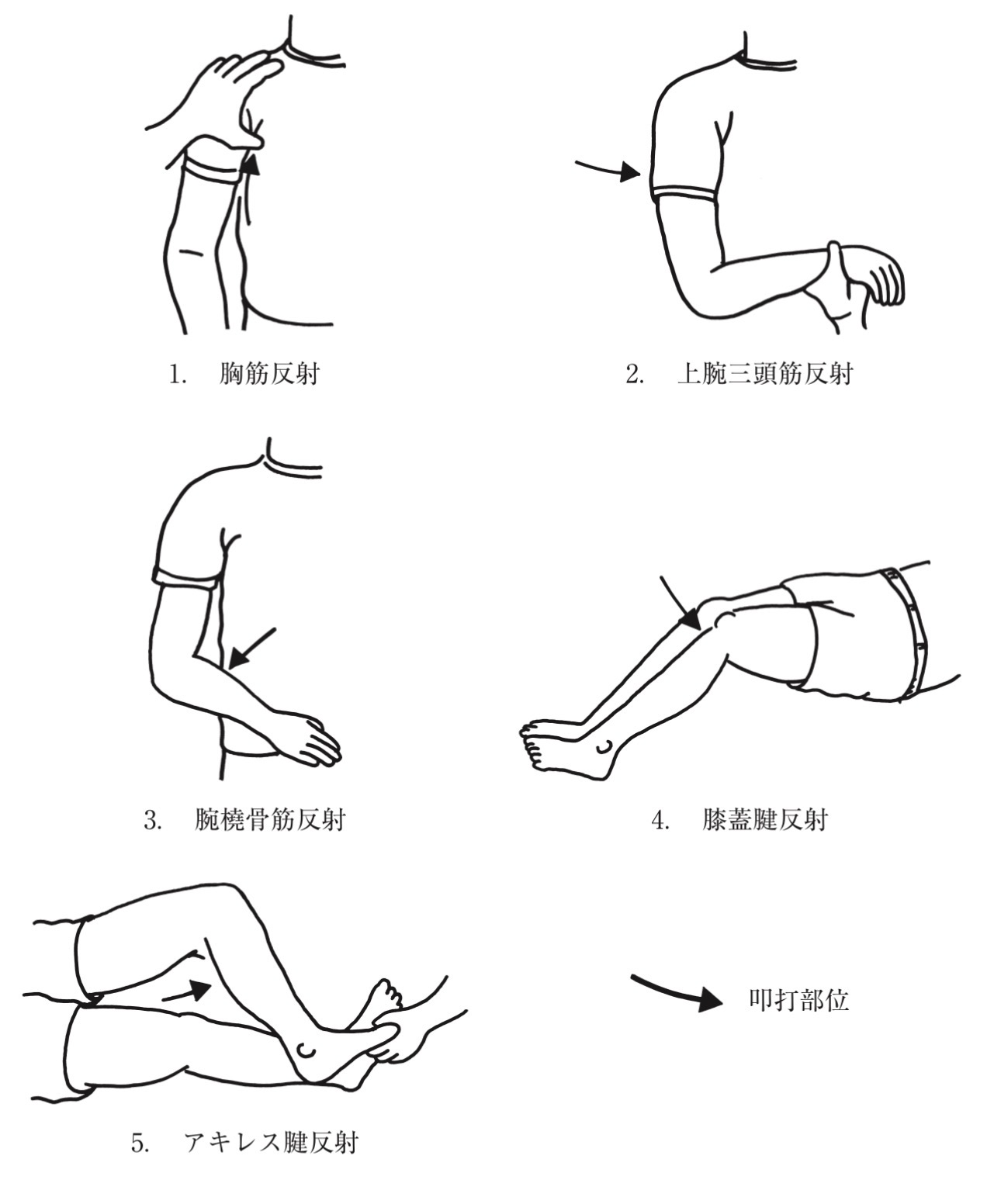 問題2の図