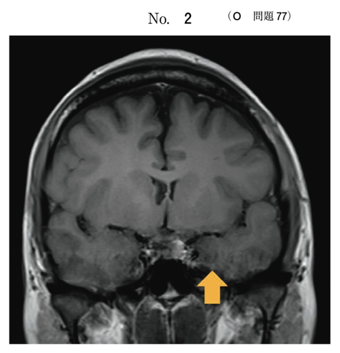 問題77の図