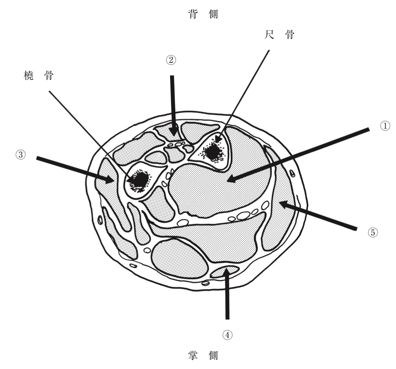問題5の図