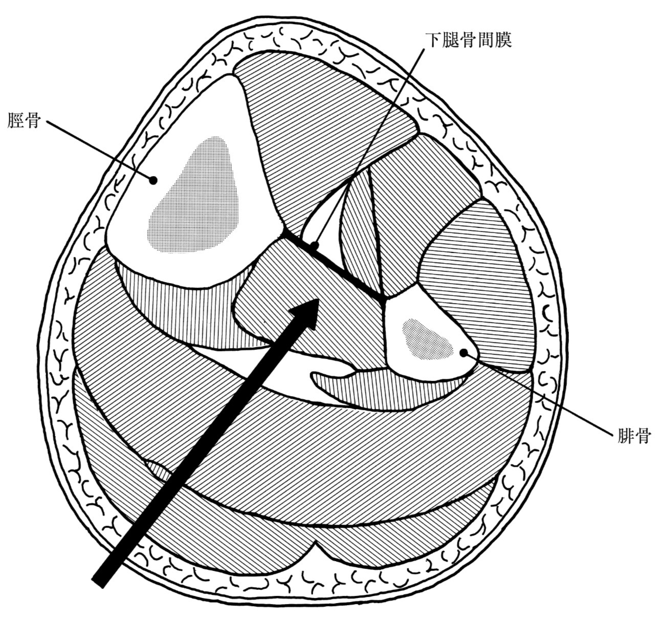 問題72の図