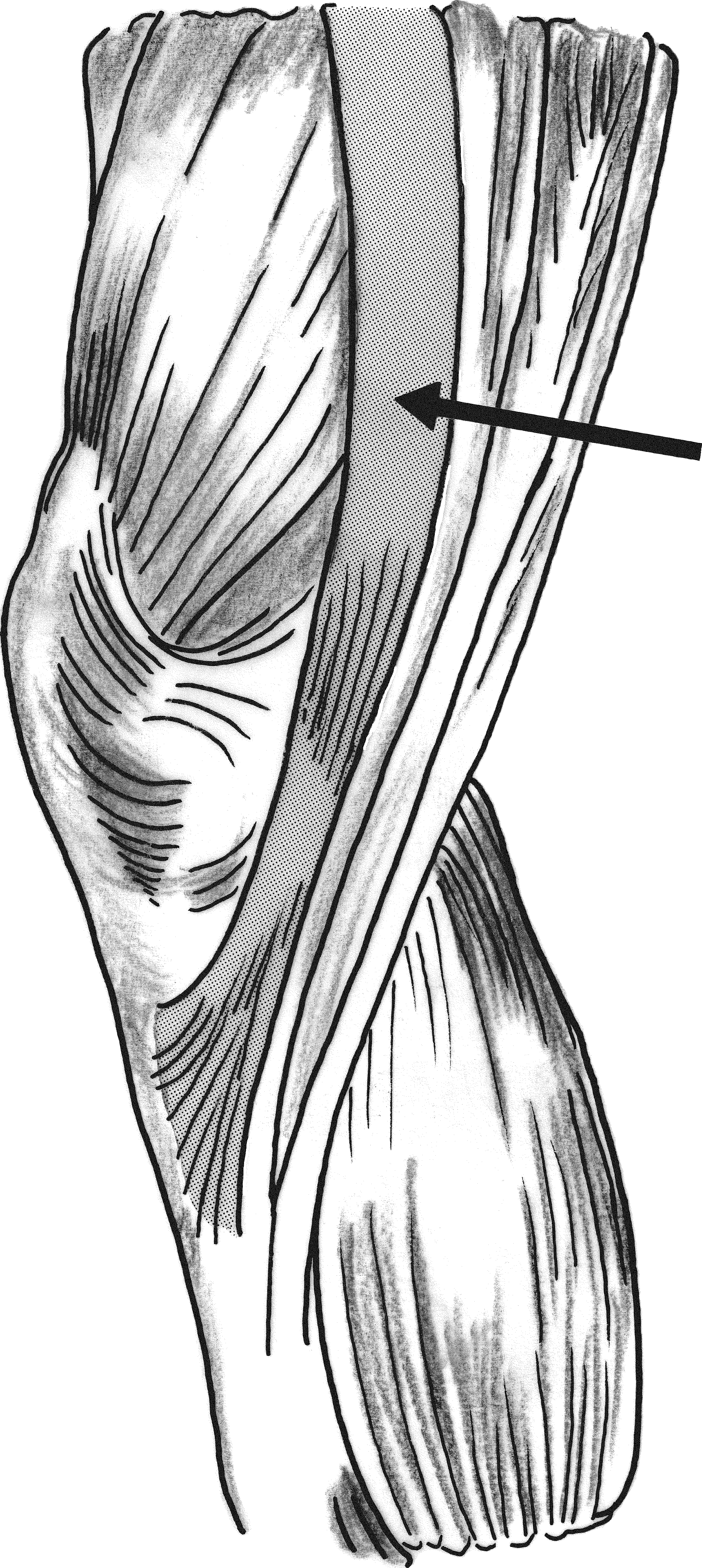 問題72の図