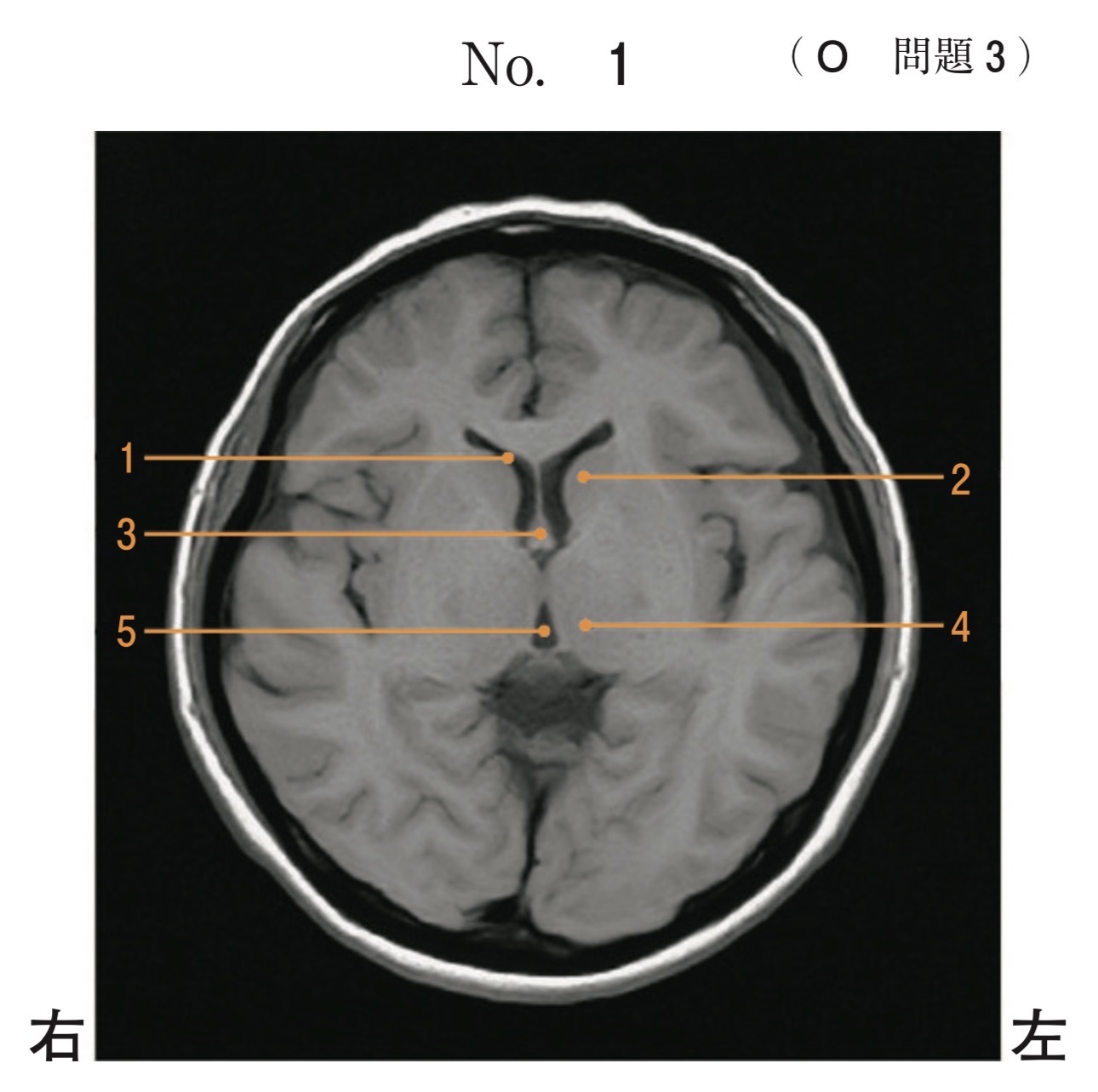 問題3の図