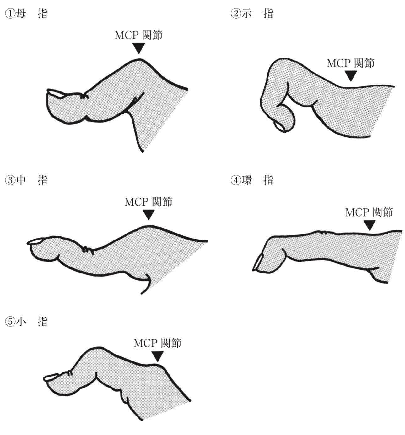 問題5の図