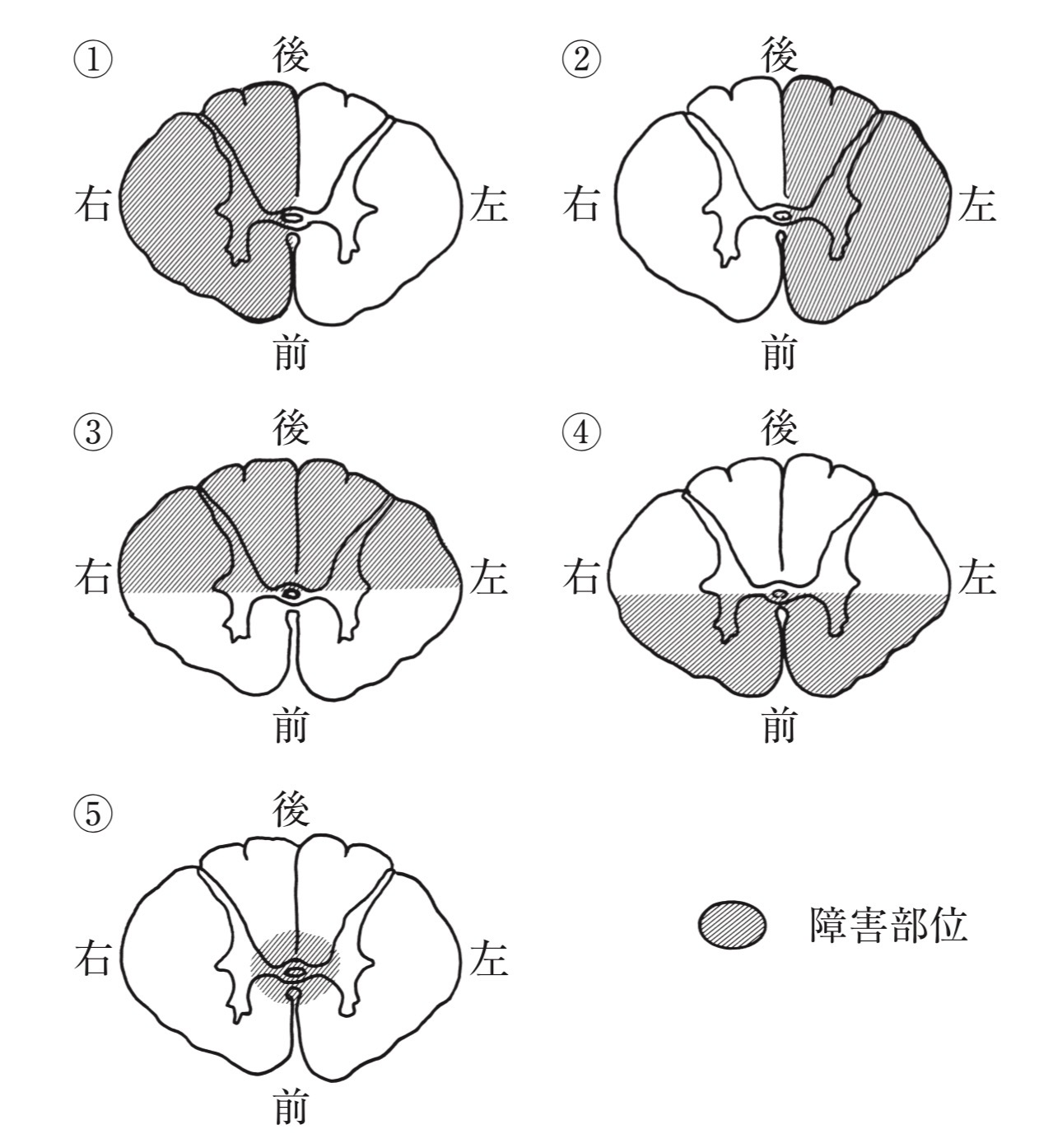 問題4の図2