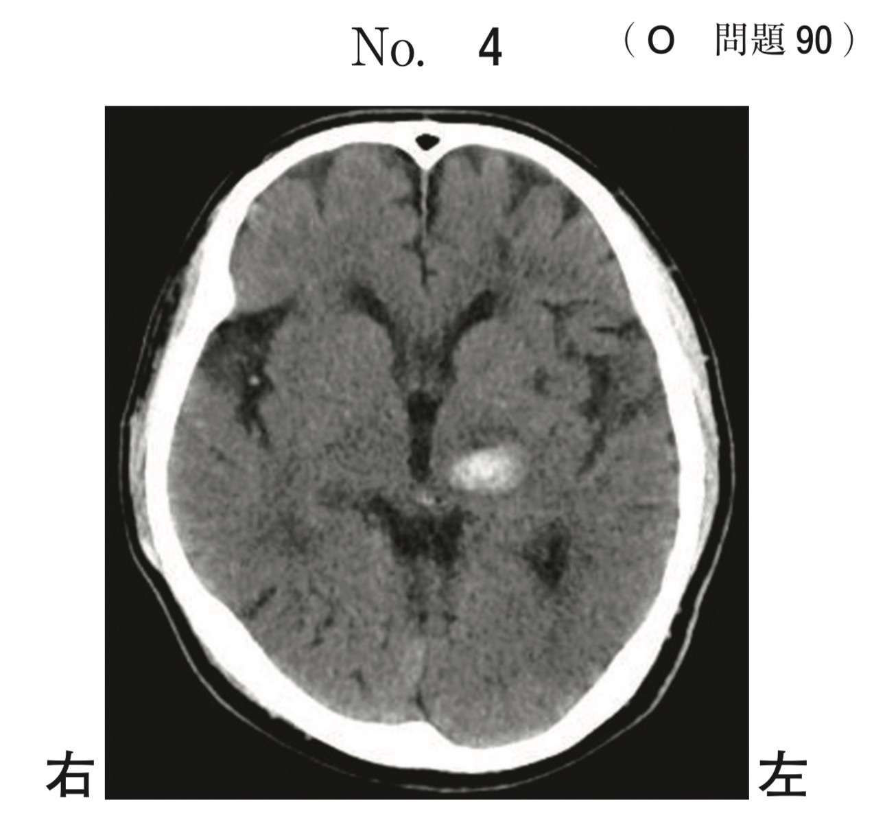問題90の図