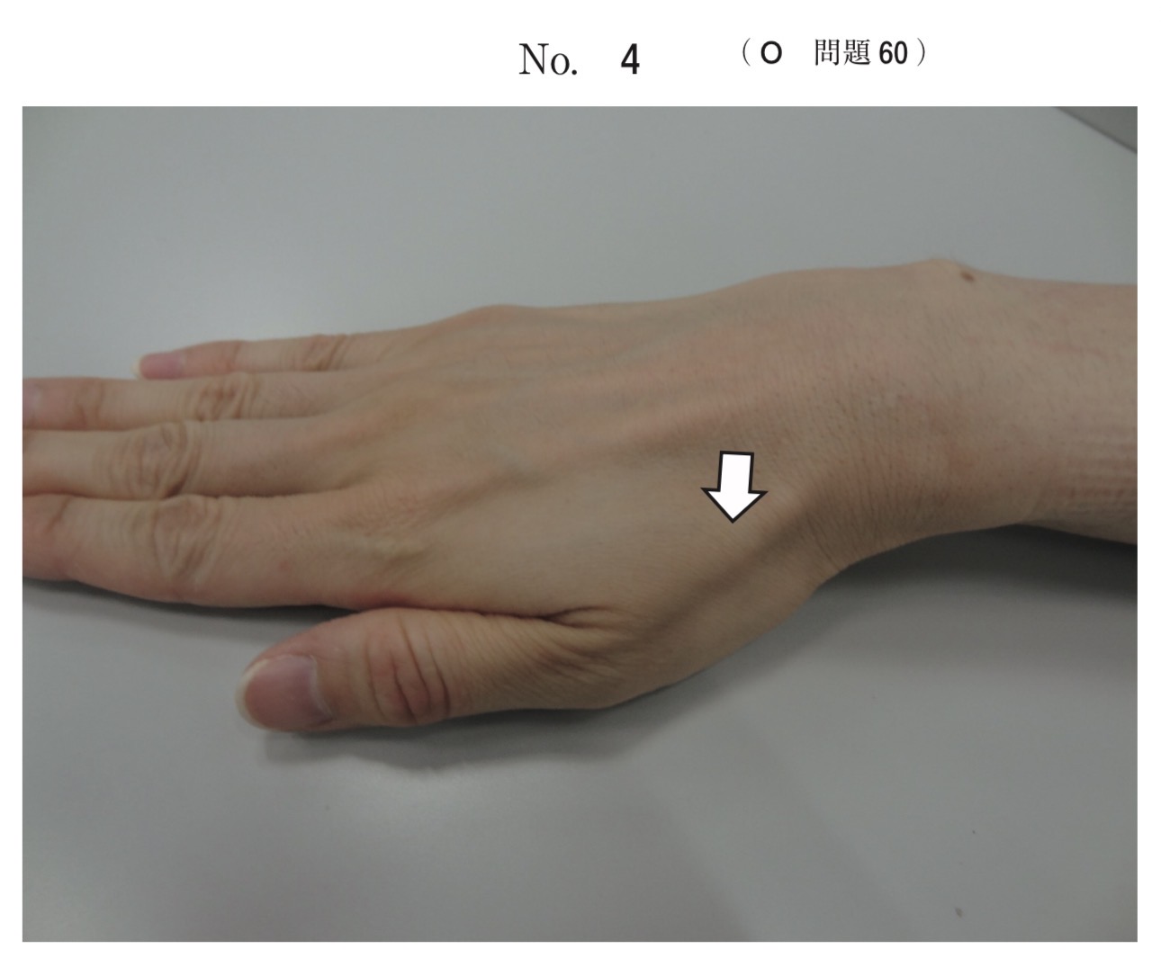 問題60の図
