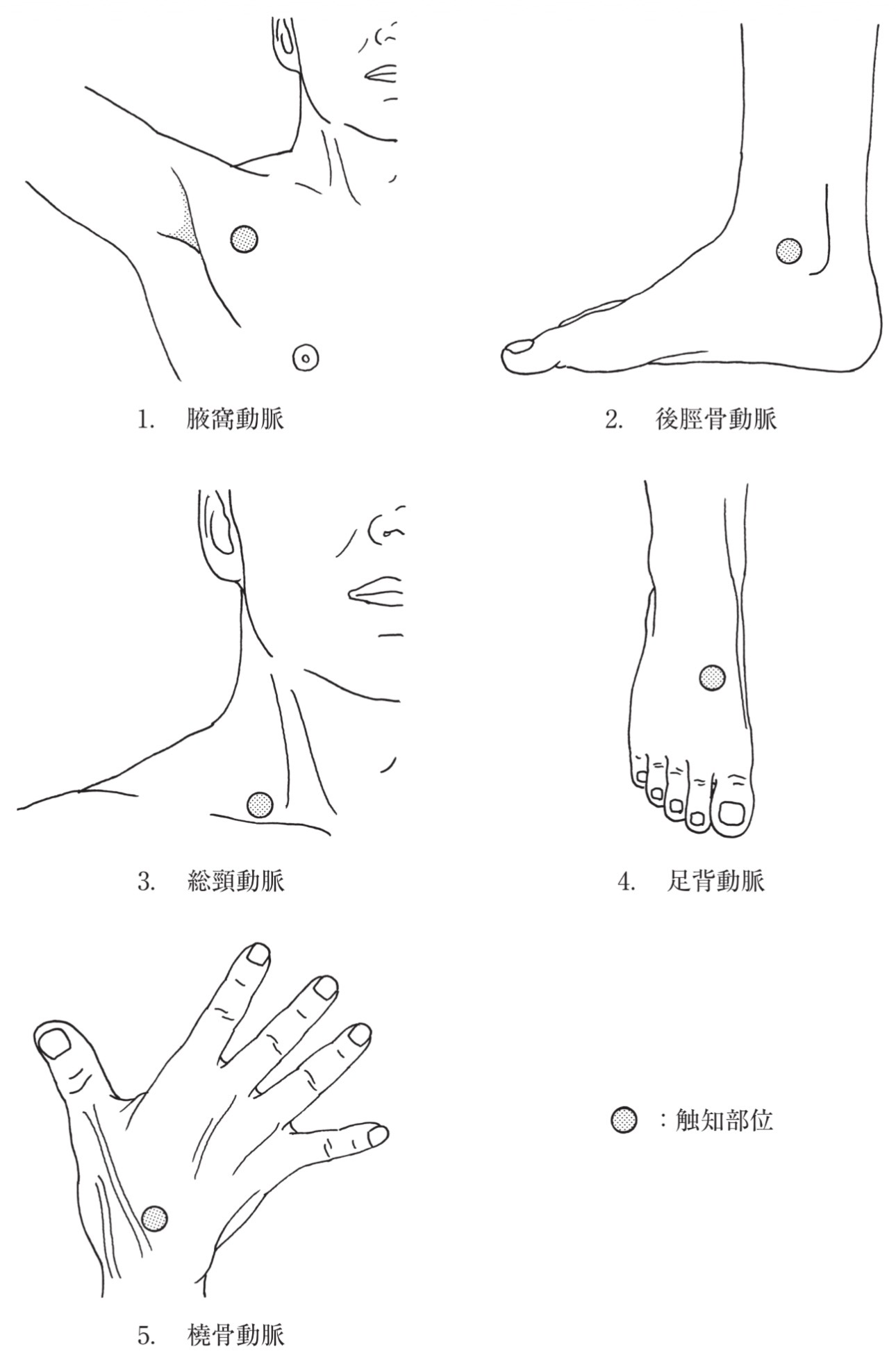 問題59の図