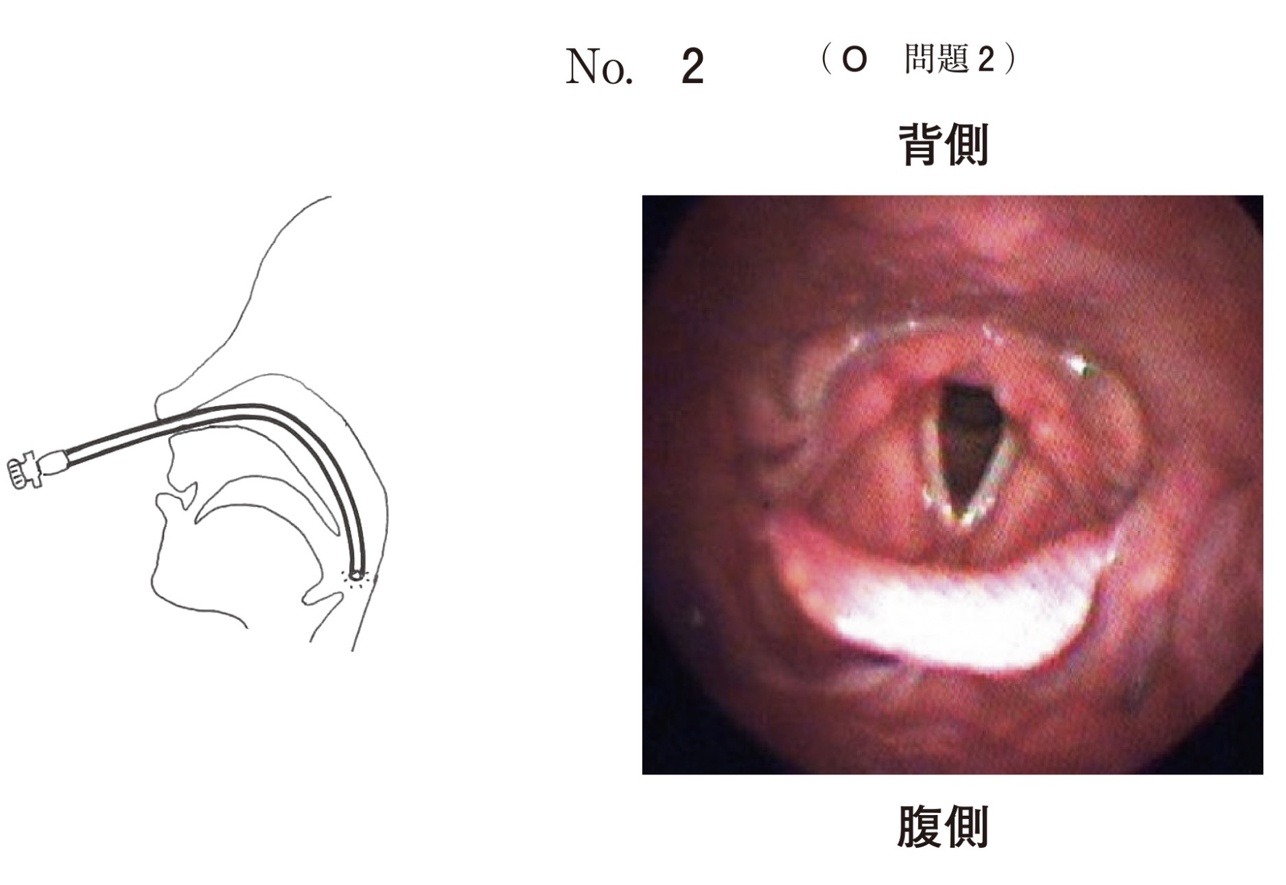 問題2の図