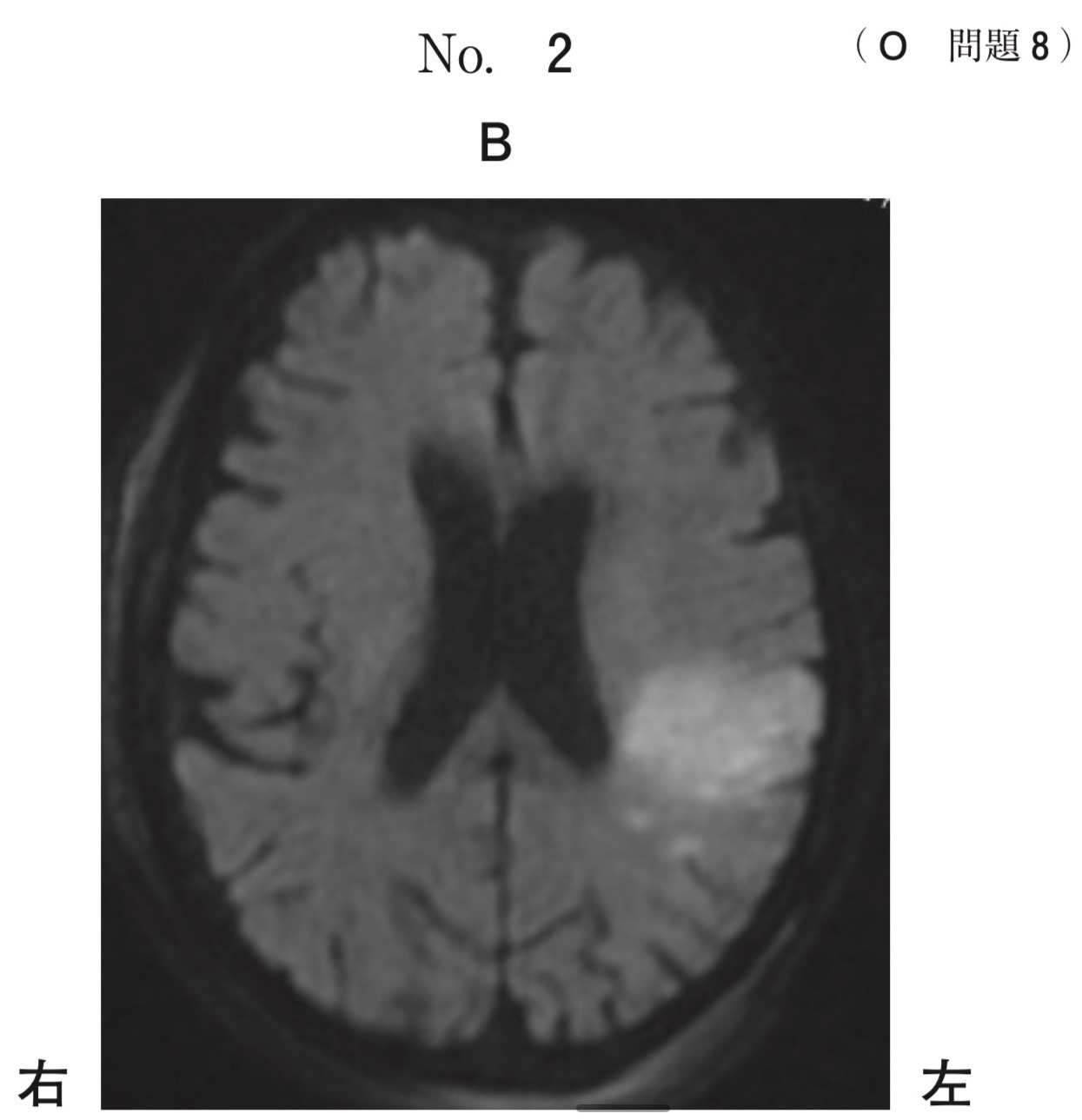 問題8の図2