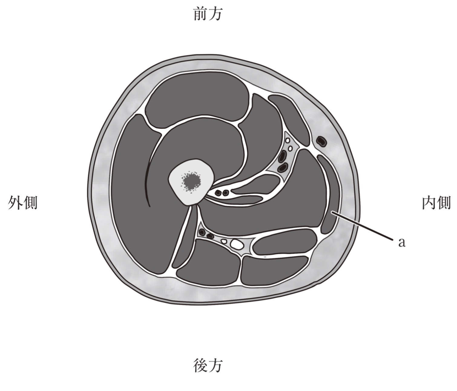 問題51の図